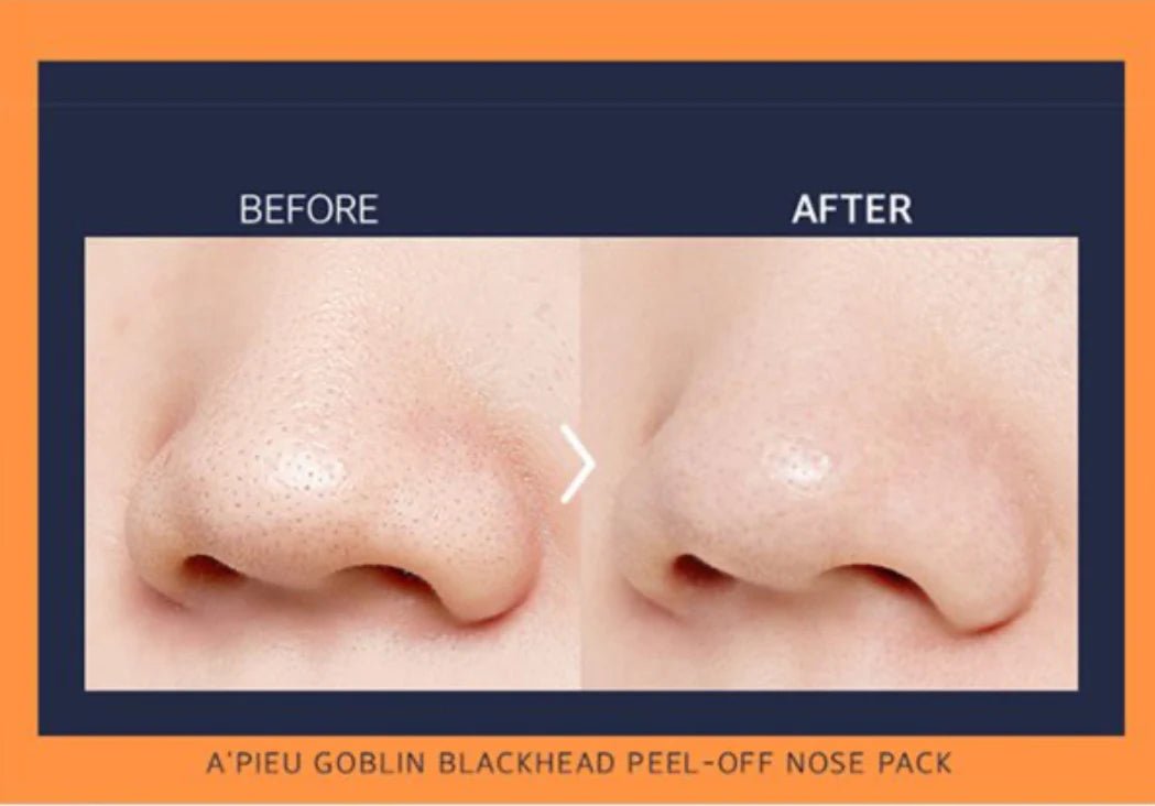 Apieu goblin blackhead 3 - step nose pack - KBOX