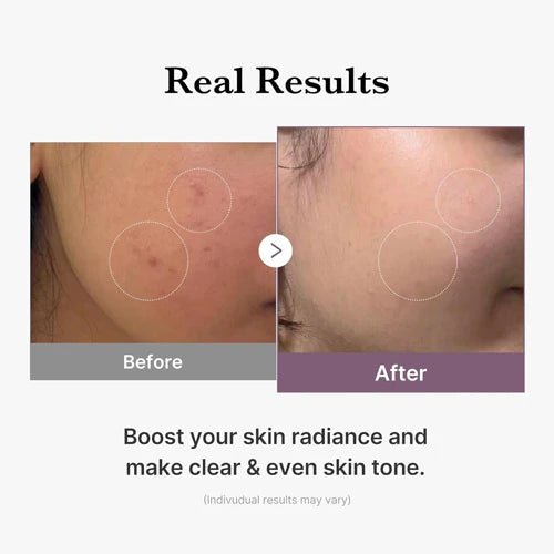 Medicube age - r glutathione glow toner 140ml - KBOX