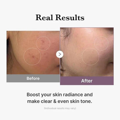 Medicube age - r glutathione glow toner 140ml - KBOX