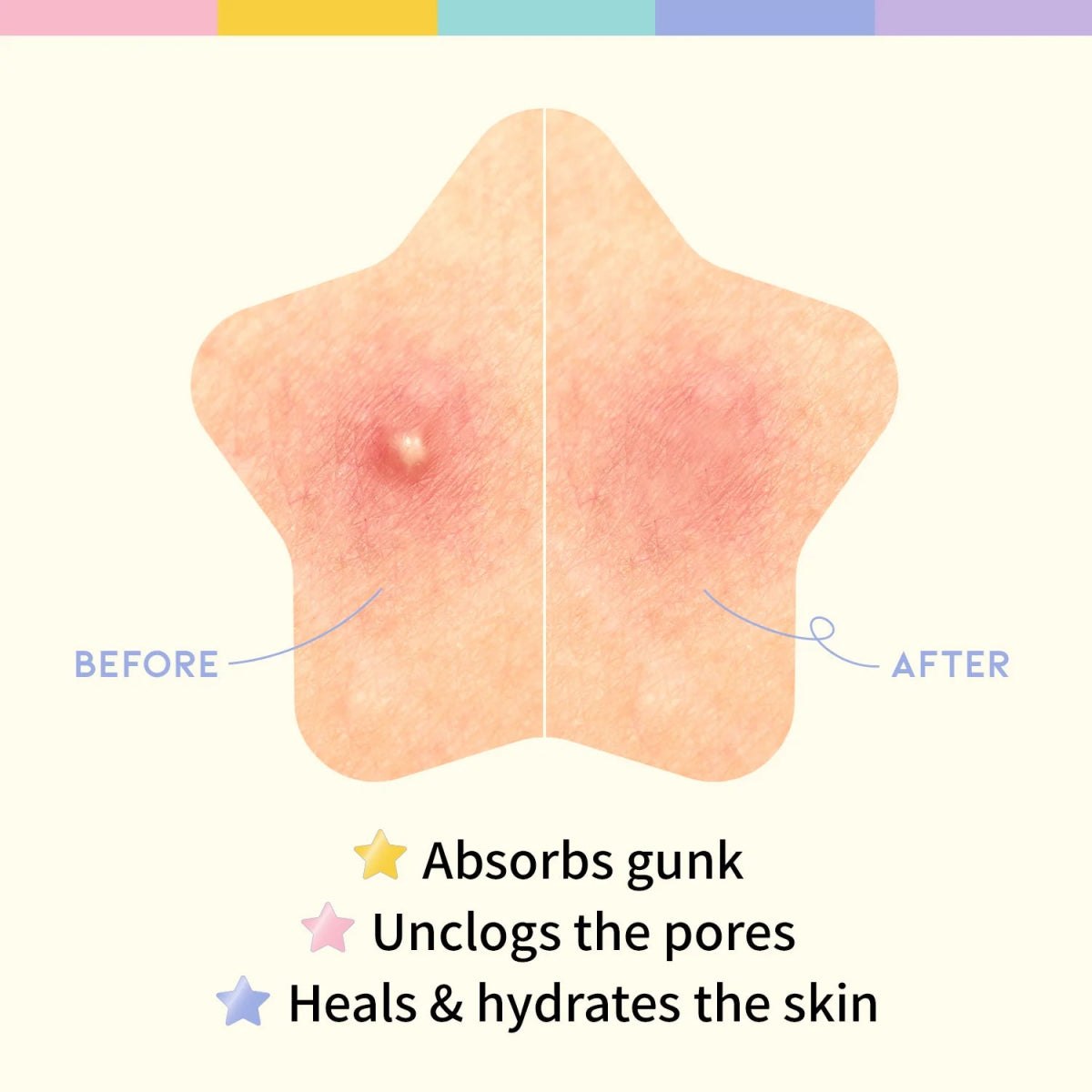 OOTD BEAUTY Star Spot Patch – Parches Estelares para el Tratamiento de Granos y Acné - KBOX