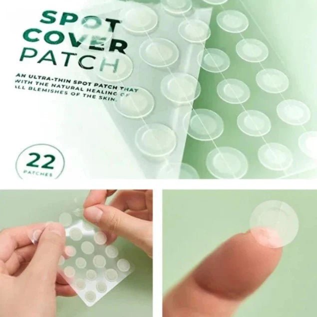 SKIN1004 Spot Cover Patch 22pcs - KBOX